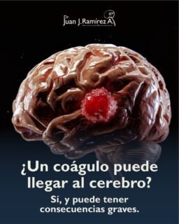 🚨 No todos los eventos cerebrales comienzan en el cerebro.
A veces el problema inicia lejos y el tiempo es determinante.
🧠 Actuar rápido puede cambiar el pronóstico.
