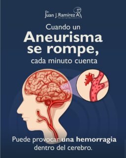 Los síntomas del aneurisma pueden aparecer de forma repentina y evolucionar rápidamente, convirtiéndose en una emergencia médica que requiere atención inmediata. Reconocer las señales y actuar a tiempo puede marcar la diferencia en el pronóstico. Ante cualquier síntoma de alarma, acude a urgencias sin esperar. Mándanos mensaje para agendar tu consulta de valoración.
📲 Agenda tu valoración: 33 3113 2125
📍 Guadalajara, Jalisco.