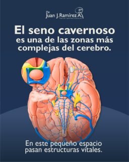 🧠 Hay zonas del cerebro donde cada milímetro importa.
El seno cavernoso es una de las regiones más complejas, donde convergen estructuras clave para funciones como la visión, el movimiento ocular y la sensibilidad facial.
Por eso, cualquier alteración en esta área requiere un enfoque altamente especializado. Agenda tu consulta y recibe atención especializada a tiempo.
 📲 Agenda tu valoración: 33 3113 2125
📍 Guadalajara, Jalisco.