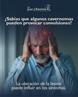 🧠 No todas las convulsiones son lo que parecen. En algunos casos, pueden ser la primera señal de una condición cerebral que requiere atención especializada.
La ubicación de la lesión y un diagnóstico oportuno pueden marcar la diferencia en el tratamiento.
 📲 Agenda tu valoración: 33 3113 2125
 📍 Guadalajara, Jalisco.